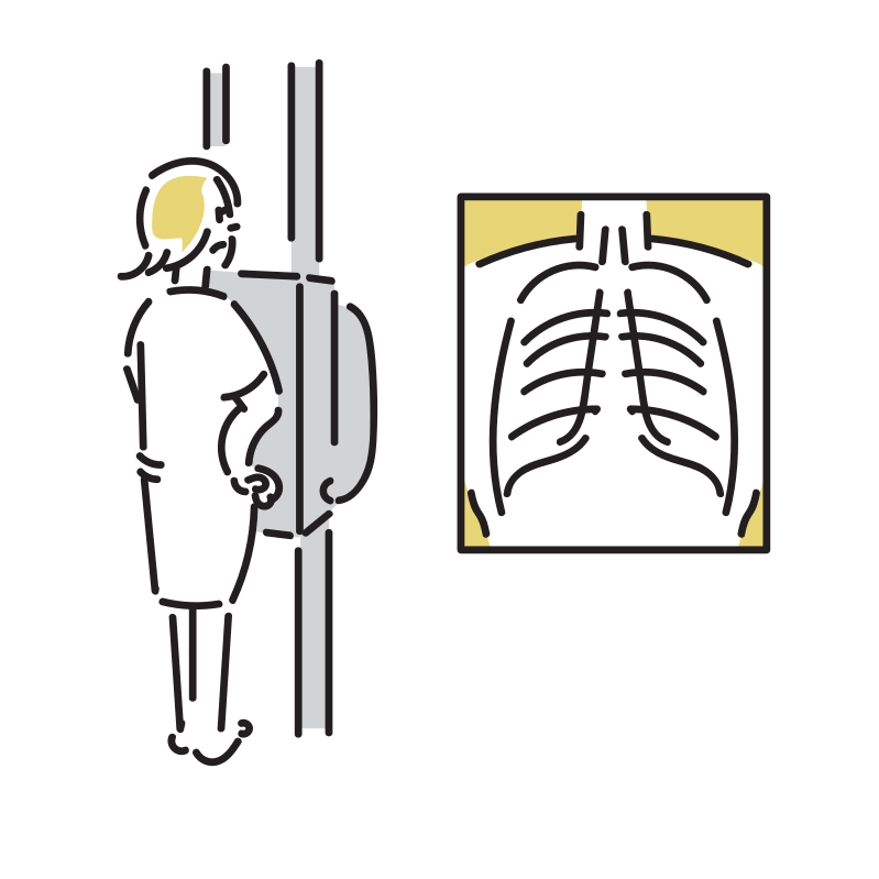 胸部レントゲン検査のイラスト
